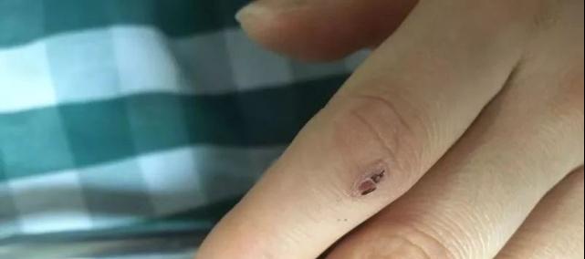 安徽工地发现一条剧毒眼镜蛇,野外银环蛇咬伤事件