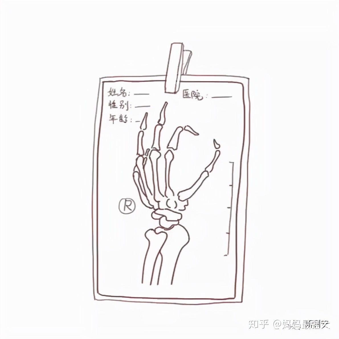 怀孕30天ct辐射对胎儿有影响吗,辐射如何影响胎儿健康状况