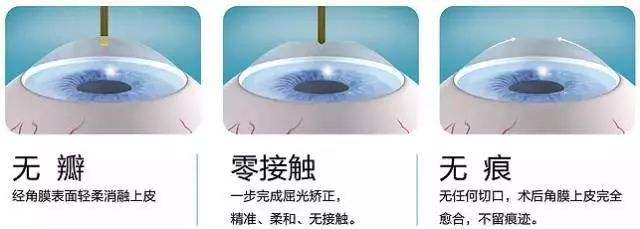 眼睛近视了做手术有什么注意事项,眼睛近视做激光手术需要注意什么