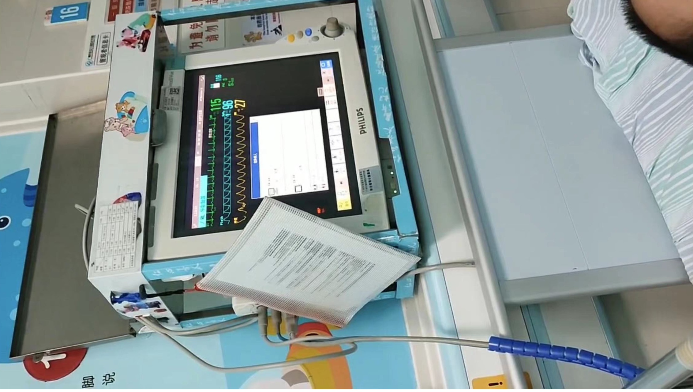 icu救治,icu抢救成功案例