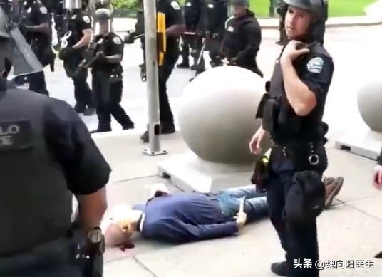 后脑勺着地可能出现什么症状,后脑勺着地算什么伤