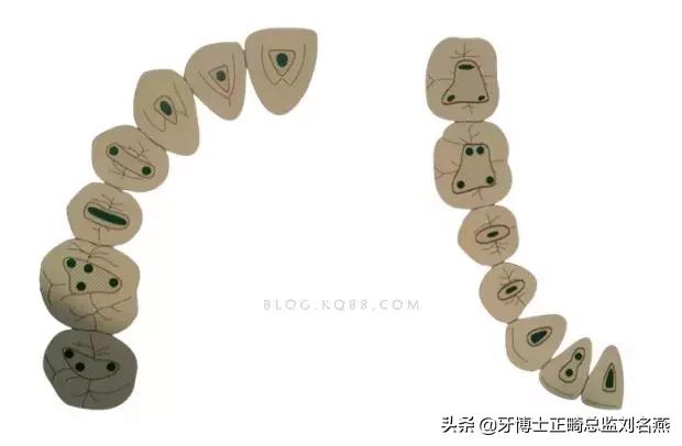 根管治疗难点与解决方案,根管治疗牢固吗