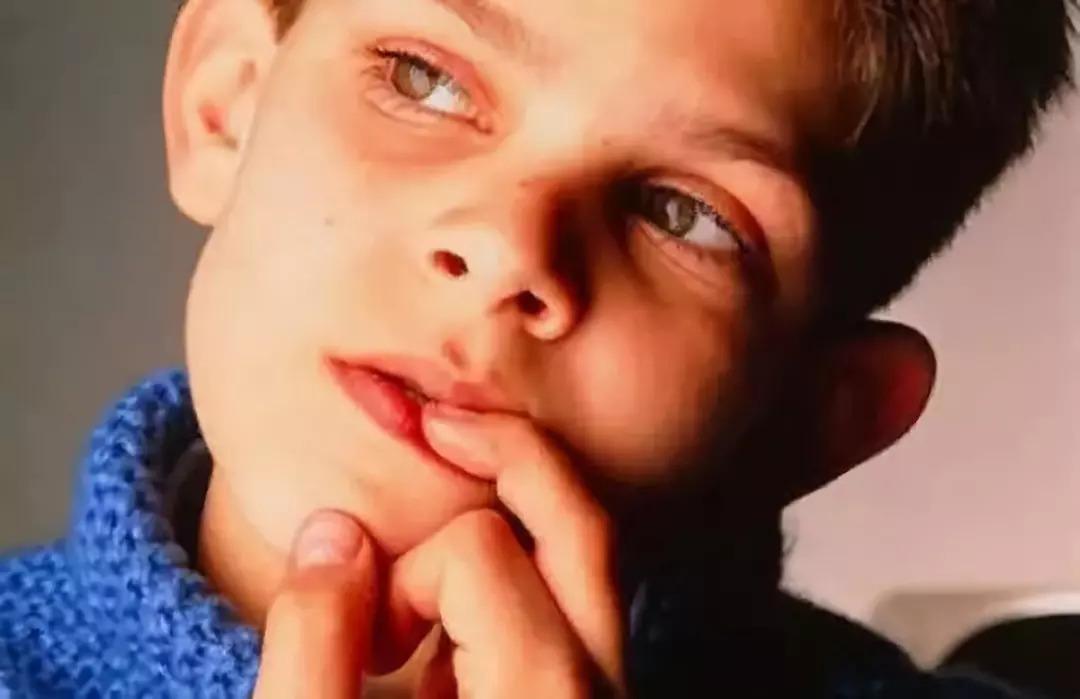 如何判断手上水泡是手癣还是疱疹,忍不住撕手指皮怎么办