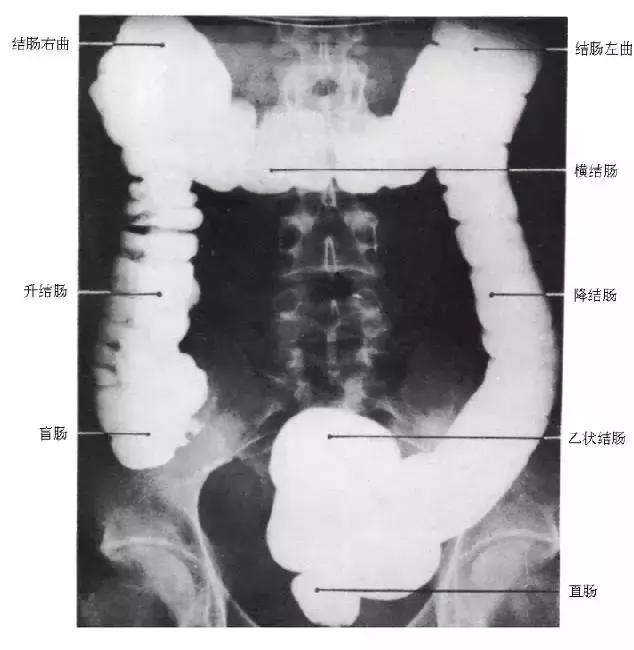 「收藏」11种消化道造影解剖图谱