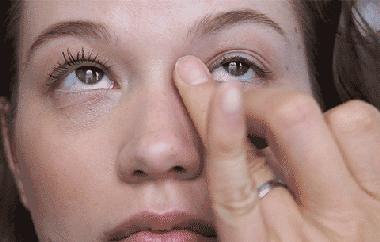 别再用针挑！用米澳拉，脂肪粒自己“掉”下来，效果胜过医美激光