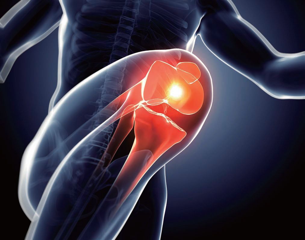 运动完膝盖里有积水怎么办,膝盖积液会导致膝盖肿胀吗