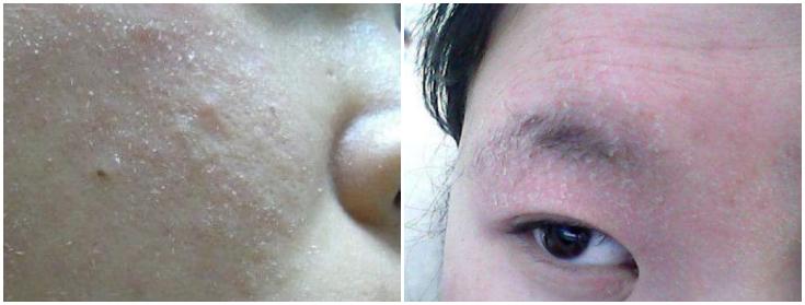 科颜氏高保湿面霜125ml免税店价格,科颜氏高保湿面霜才180元