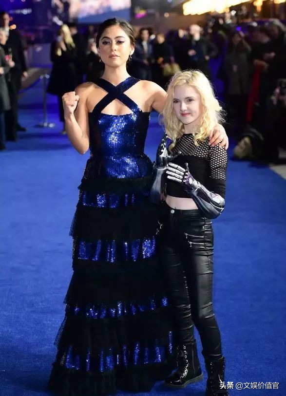 真实版“战斗天使”阿丽塔：13岁机械臂美少女，励志到哭！