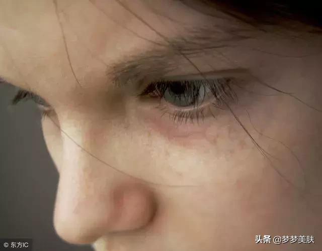 严重的黑眼圈眼袋怎么解决,教你消除黑眼圈眼袋和细纹