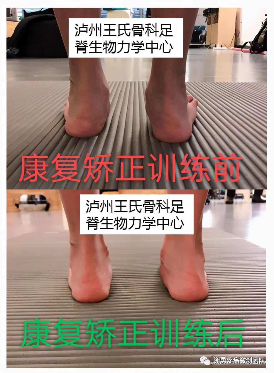 下肢不舒服查什么科,下肢不舒服做什么检查