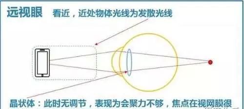 儿童眼科常见病有哪些,家长收藏孩子生病要用的药物
