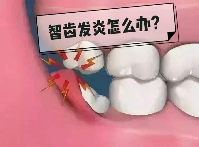 智齿发炎疼痛怎么缓解,电动牙刷可以预防智齿发炎吗