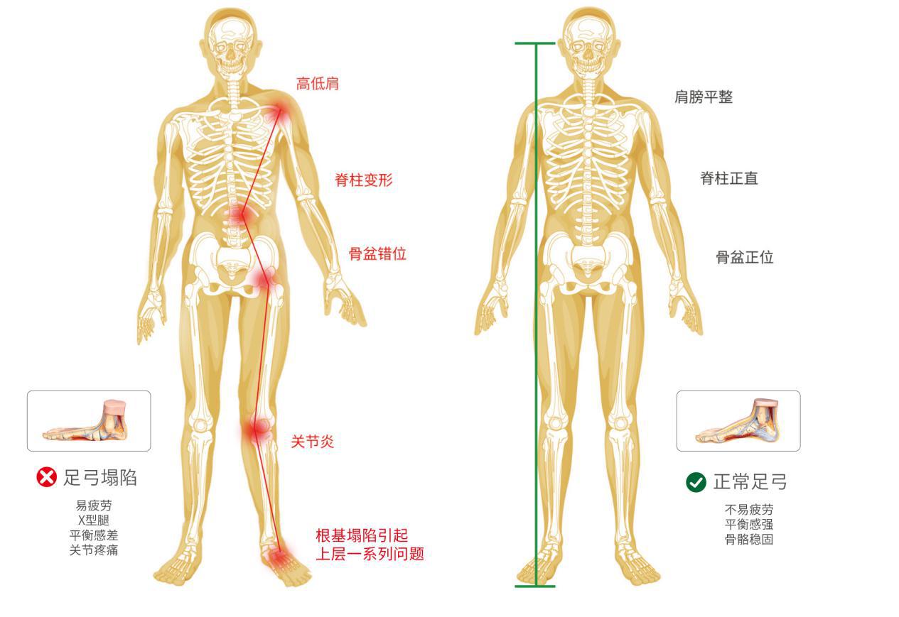 足行健按摩鞋对身体有伤害吗,为何那么多人选择徒步