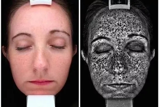 常见的淡斑误区！你犯了哪几个？