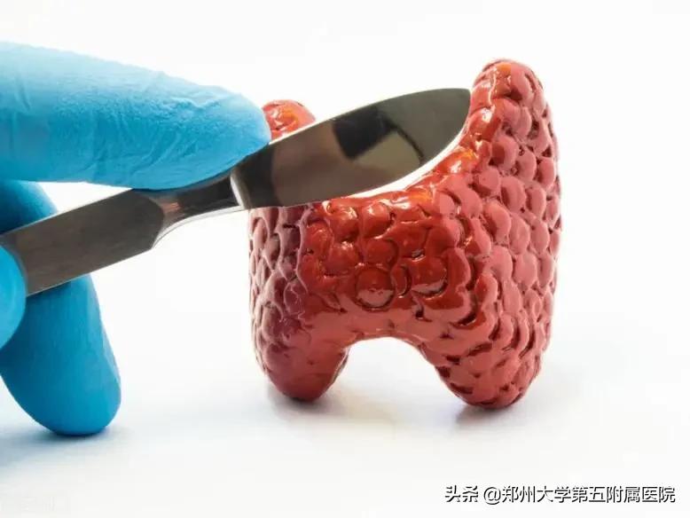 喝碘131后就瘦了几斤正常吗,碘131后有瘦下来的吗