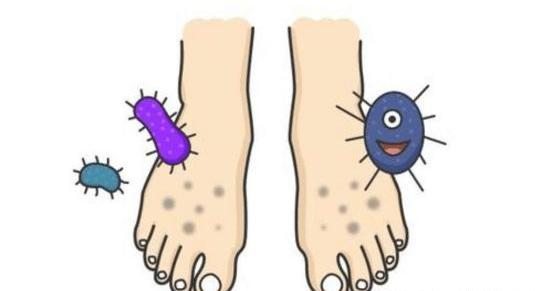 什么是脚气得了脚气怎么快速消除,脚气和真正的脚气病有什么区别