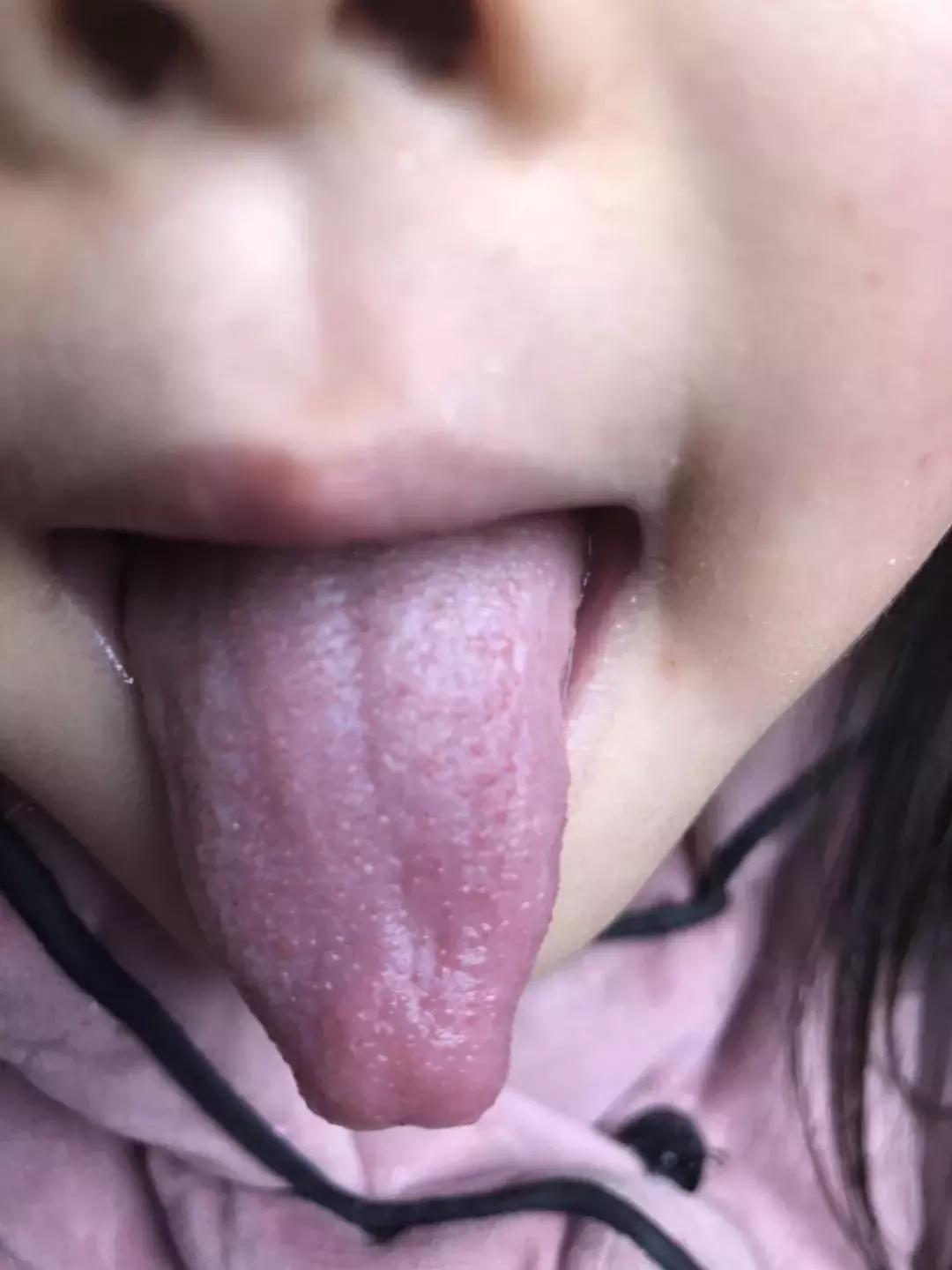 阴虚火旺虚不受补体质怎样调理,阴虚气虚气血不足脾胃不好怎么办