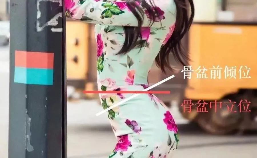 肋骨外翻且胸部突出,肋骨外翻导致胸突出