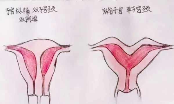 医生精美手绘图片大全,宫颈息肉红蓝铅笔手绘图