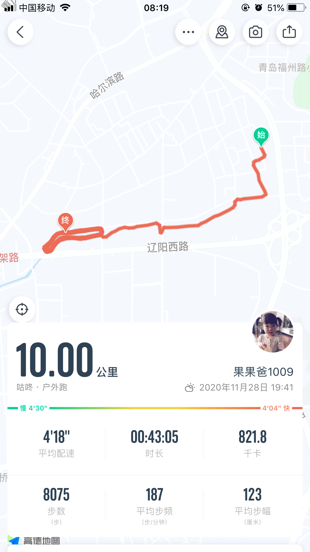 尿毒症透析患者日常分享,尿毒症患者的透析日常