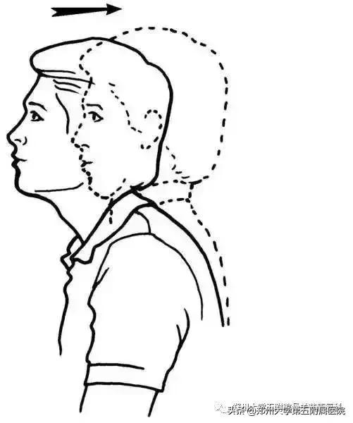 枕大神经痛是偏头疼吗,枕大神经痛能引起头痛吗