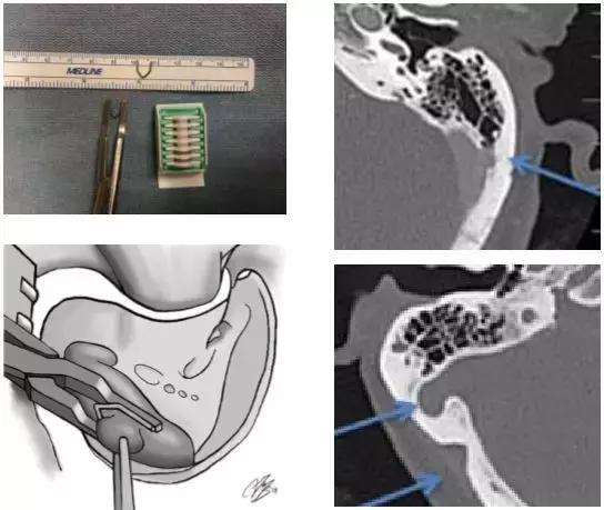 科普文的趣味性,趣味性科普文