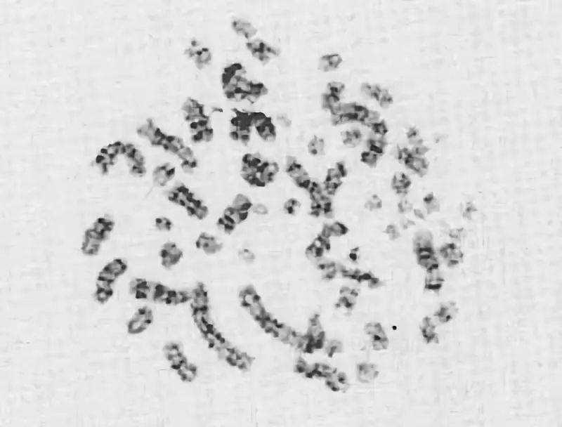 83天核事故救治纪录片,核灾83天死亡全记录
