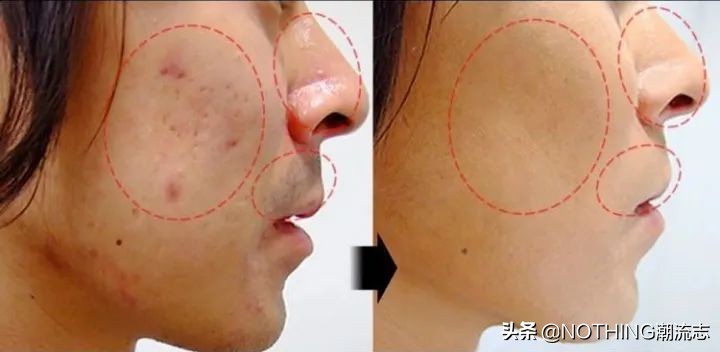 肤色比较黑的男生怎么穿搭,肤色黑的男生适合什么颜色的衣服