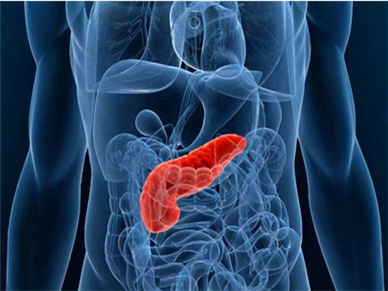 一顿酒小伙住进ICU,花五六十万,只因会自我消化的急性胰腺炎