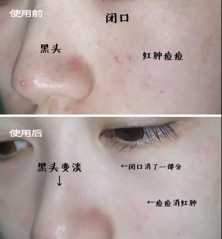 张天爱视频用的保养护肤面霜,张天爱作息曝光视频