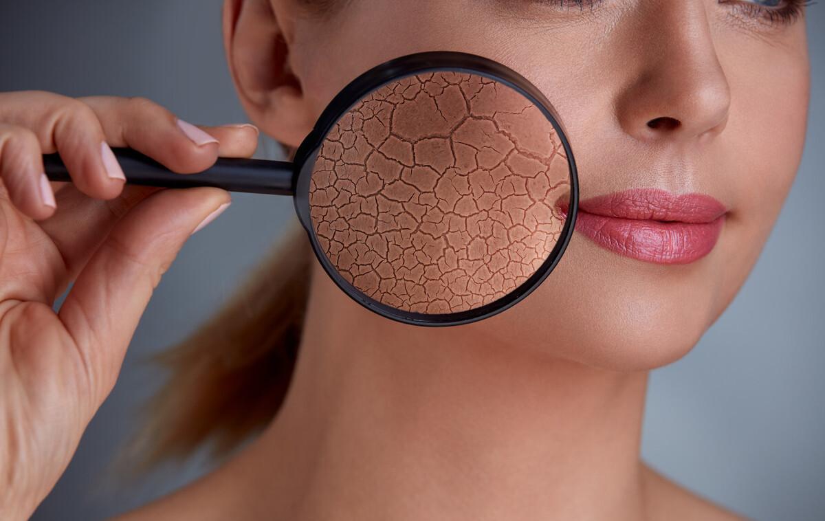 光子嫩肤做了多久可以做果酸换肤，真的能让毛孔收敛吗？