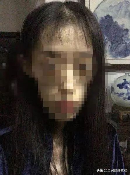 极端减肥的方式,极端却有效的减肥方法