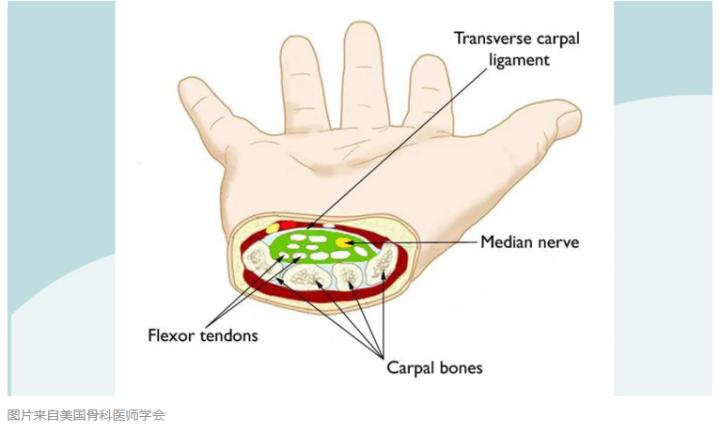 高血糖引起手臂疼痛是啥病,左手大拇指和食指发麻和高血糖