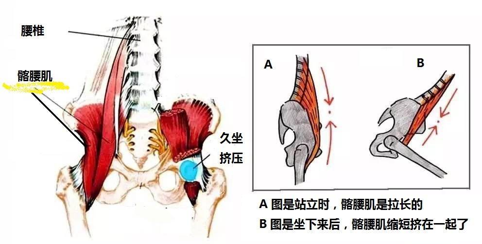 久坐腹股沟酸胀是怎么回事,久坐腹股沟疼痛的原因