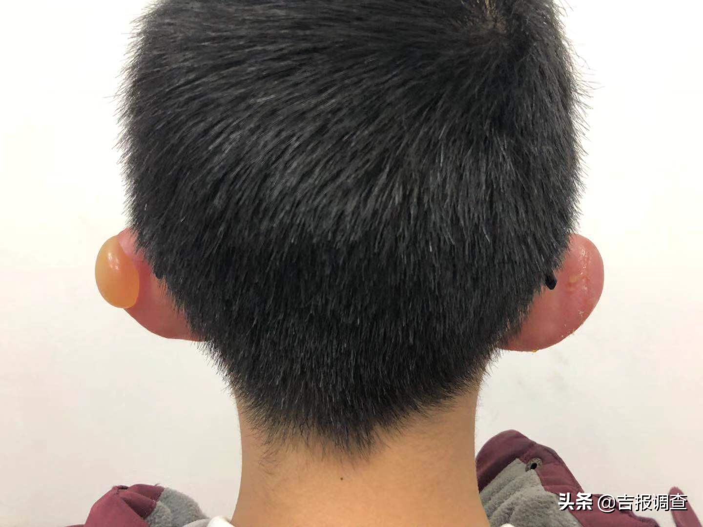 鐢峰鎵撹冻鐞冭鍐讳激,韪㈣冻鐞冪殑灏忕敺瀛╀腑鏆戝彈浼ょ殑鏍峰瓙