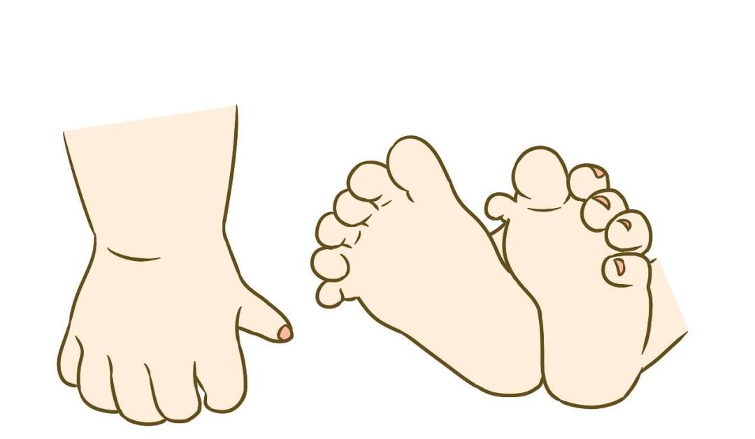 健康学堂丨多指（趾）未必多福！及早就诊才是最佳选择