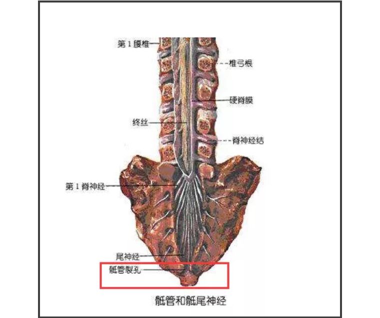 尾椎骨下方屁股两处反复长水泡,尾椎骨附近起了水泡是怎么回事