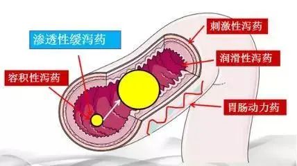 老年人便秘原因最好的解决方法,老人便秘怎么办快速解决又不伤身