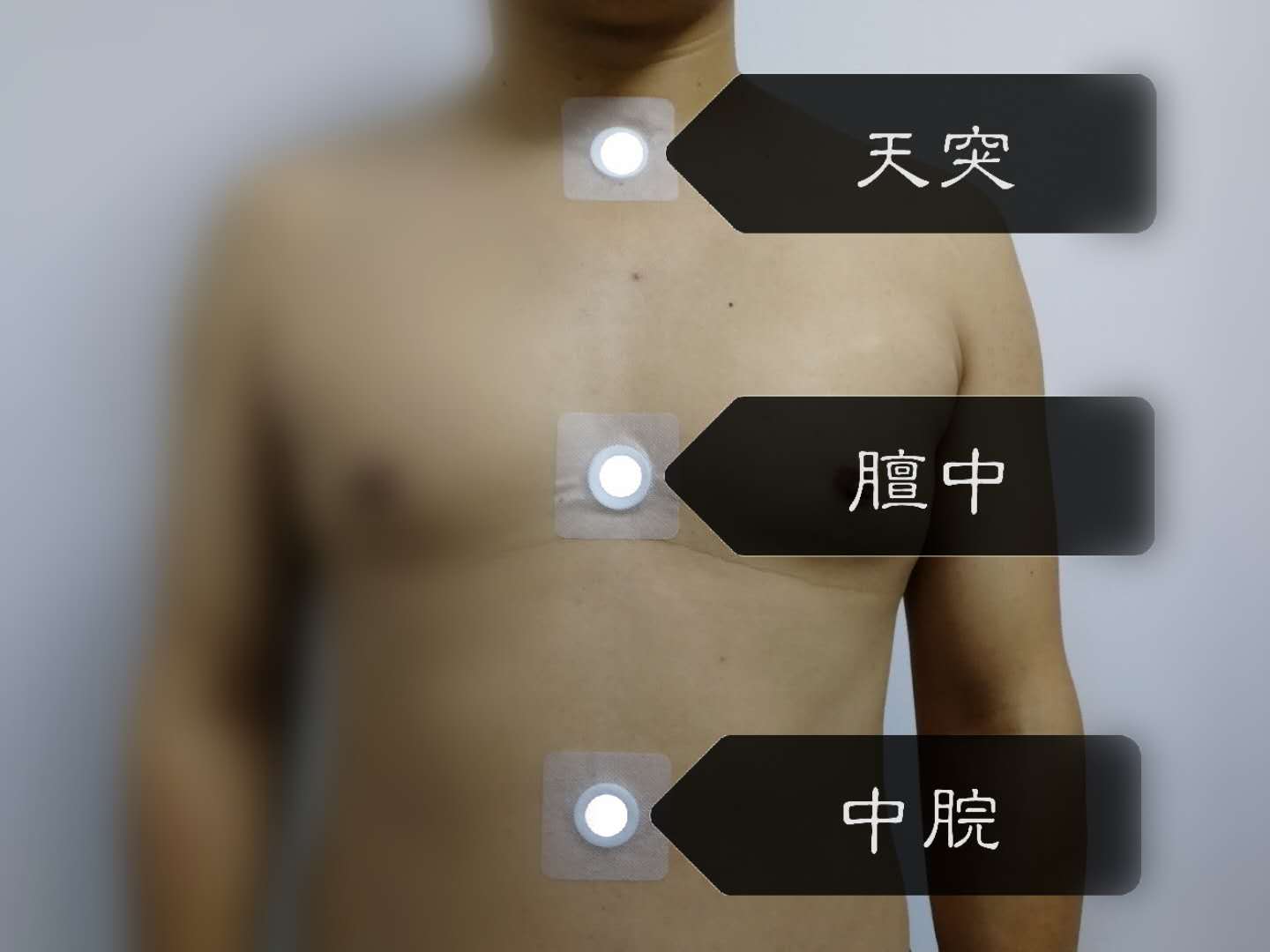 沈阳名中医讲解,有图有真相:周末三九贴敷,穴位用药作用这么看