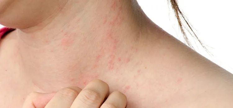 家里甲醛超标孩子有什么反应,甲醛超标身体反应婴幼儿