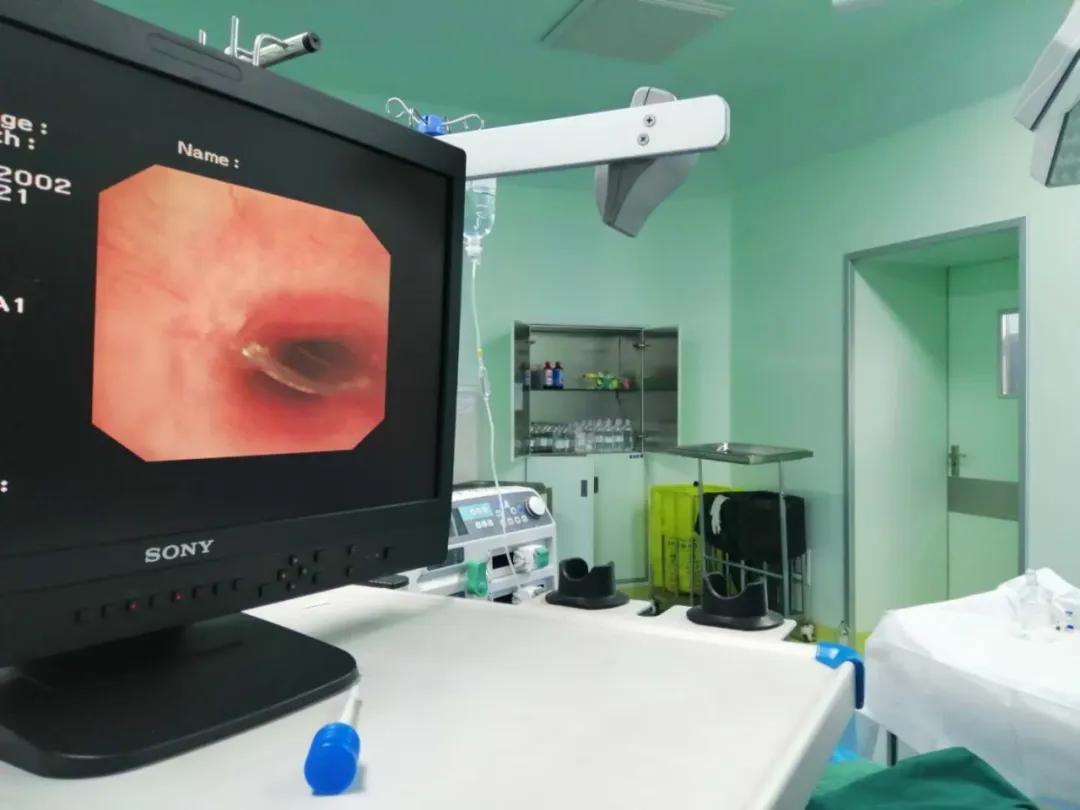 果冻卡死小孩,果冻卡住气管视频