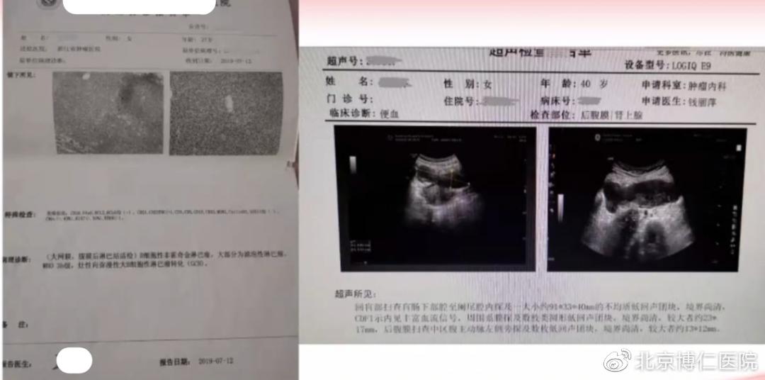 确诊淋巴瘤的最可靠依据是什么,我的淋巴瘤是遗传的能治好吗