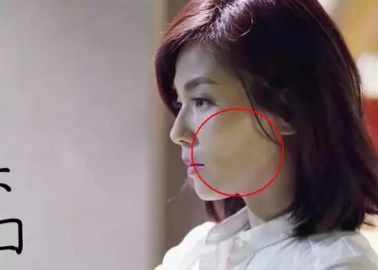 高颧骨脸颊凹妆容,高颧骨有办法改善吗