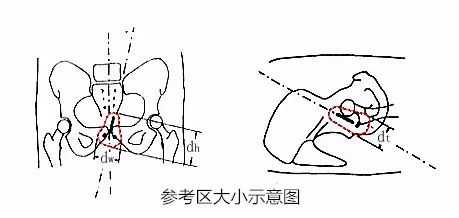 什么是近距离交叉口,什么是近距离用眼时间