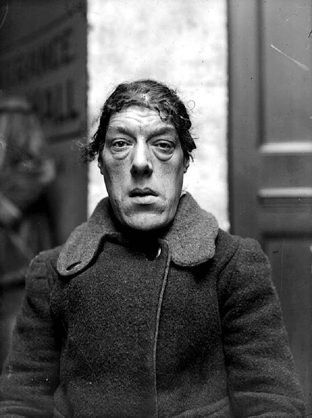 身高不足1米4，拒绝20个求婚者，死后被制成标本展览的传奇女子