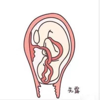 孩子不肯吸母乳怎么纠正,孩子不吸母乳母乳越来越少怎么办