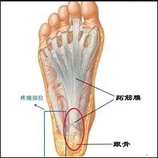 脚后跟部痒水肿,脚后跟酸胀刺痛