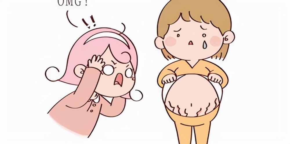 妊娠纹并不是每个孕妈都会长,长妊娠纹会怎么样孕妈必看