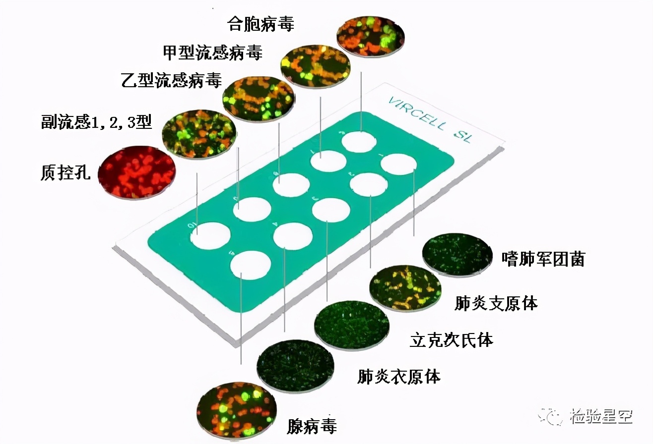 呼吸道九联检的临床意义