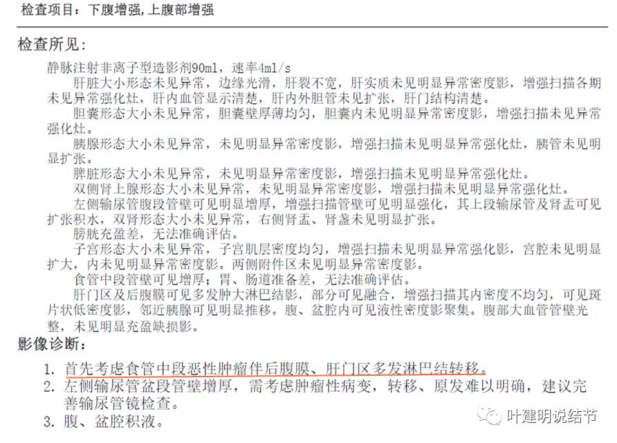 特瑞普利单抗食管癌成功案例,特瑞普利单抗治疗食管癌效果好吗